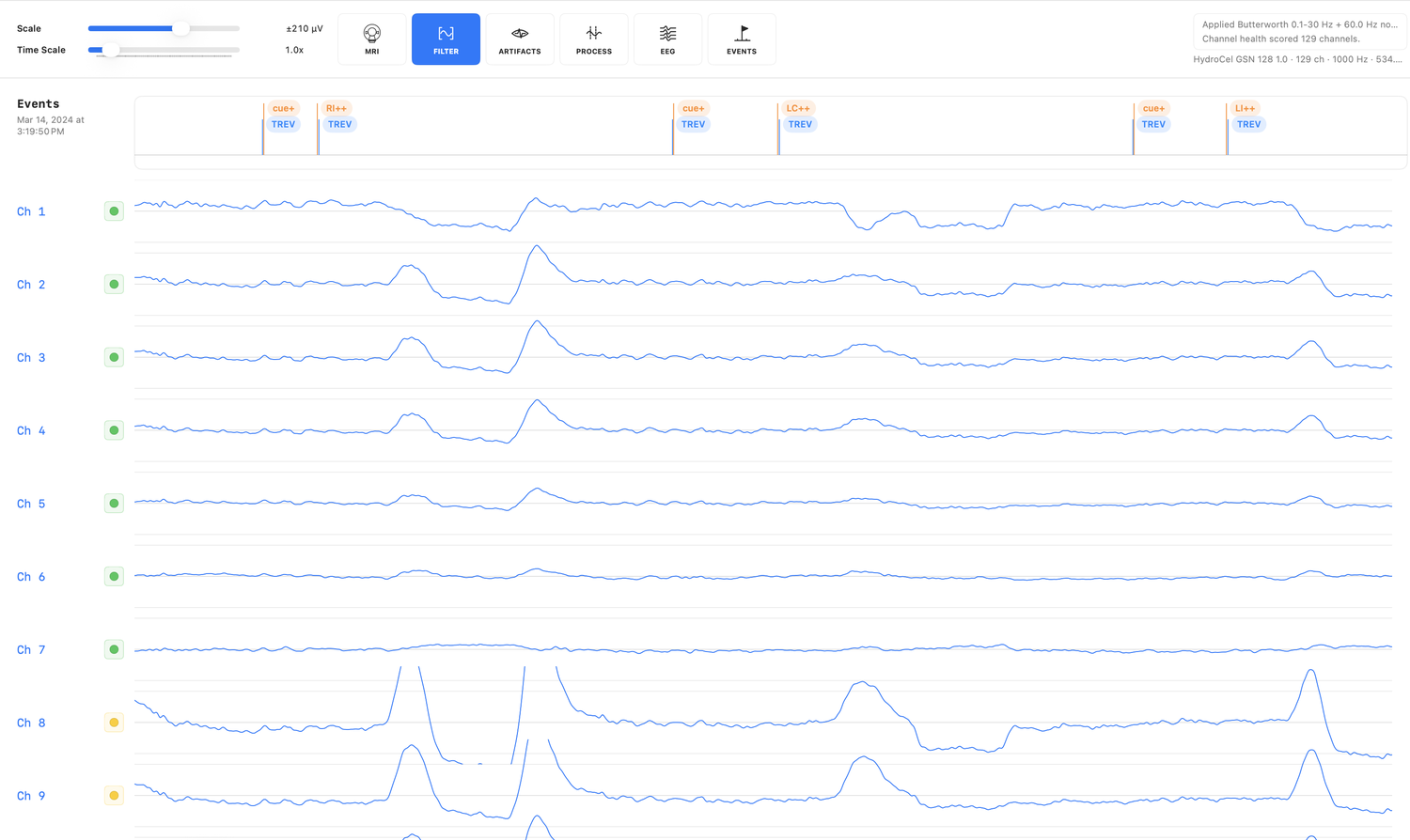 EVA waveform view with channels, events, and analysis tools